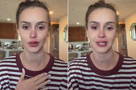 'Mormon Wives' Star Mikayla Matthews Breaks Down in Tears Over ‘Traumatic’ Skin Flare-Ups