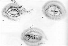Image result for eyeball enucleation cattle