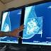 University Hospitals doctor pushes for early mammograms, despite  ...