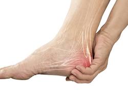 Hình ảnh về person with numb feet