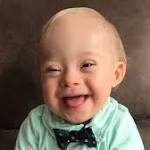  Utter cuteness! Down syndrome boy steals Gerber execs' hearts in photo contest