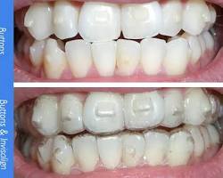What are the types of Dental Treatment?