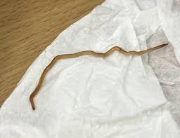 Worm found in cabbage : r/Parasitology