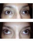 Temporary eyelash extensions