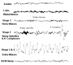 Image result for Sleep and stages