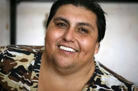 Questo il record di Manuel Uribe, 43enne messicano. Era l&#39;uomo più grasso del mondo, con 550 chili quando, nel gennaio 2006, è stato operato a Modena. - reuters129323281405140757_big