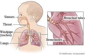 Home Remedies Pneumonia