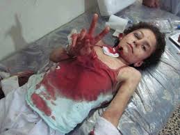 Image result for gaza jpg dead children