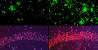 Harvard Medical School - News update