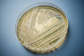 Emerging Threat: Candida Auris Fungal Infections Take Hold in Washington - 1