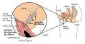 Incontinence urinaire pdia