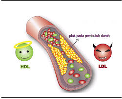 kolesterol ldl