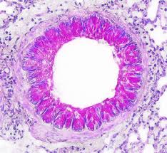 pathology এর চিত্র ফলাফল