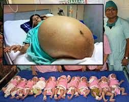 Image result for delivery baby