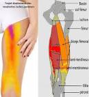 Cruralgie ou laposinflammation du nerf crural Libertalia