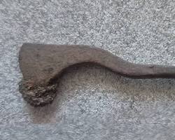 ancient surgery tools and trepanned skull archaeology resmi