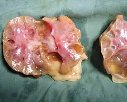 cat with polycystic kidney diseaseの画像