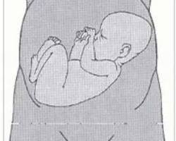 Image de bébé en position transversale