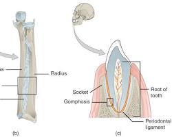 Image of Suture joint