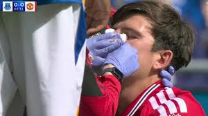 Maguire left covered in blood after collision seconds into Man Utd vs Everton — The Sun