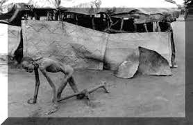 Image result for starving people