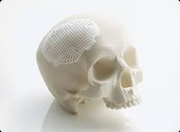 Lithoz Medical and Dental Ceramic 3D Printer | Objective 3D