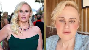 Rebel Wilson Details Emergency Plastic Surgery After On-Set Accident During "Bride Hard" Filming