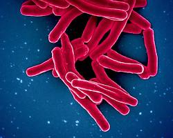Image of Mycobacterium tuberculosis bacteria