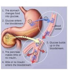 Resultado de imagem para diabetic