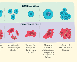 Image of Cancer cells under a microscope