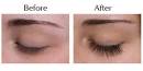 Eyelash extension removal cost