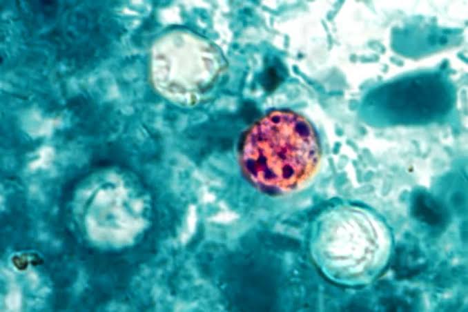 Michigan health officials report first two deaths linked to Cyclospora outbreak; state reports 2 deaths amid Cyclosporiasis outbreak