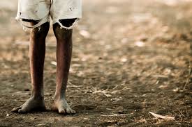 Image result for african poor man