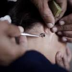  Is Bee-Sting Acupuncture Safe? Spanish Woman Dies After Apitherapy