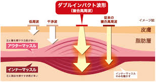 「楽トレ 画像」の画像検索結果