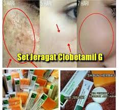 Image result for clobetamil g