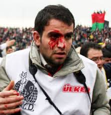 Mehmet Kayahan yaralandı Sonra Oku - 211070_detay