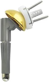 AGILON®