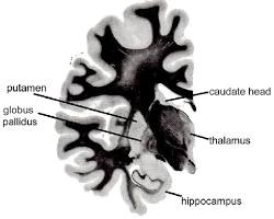 Image of Myelin staining of the human brain