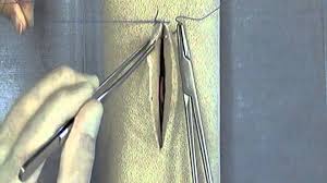 Image result for simple continuous suture pattern