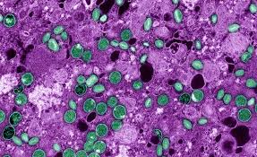 Dossiê mpox: 16 perguntas e respostas para entender a doença
