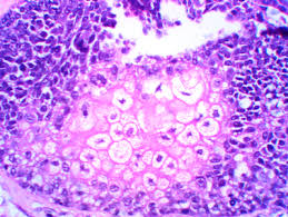 Histopathology: high magnification