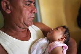 Image result for pictures of zika babies