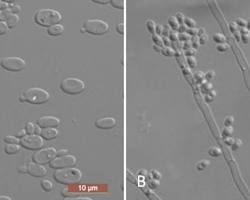 Image of Yamadazyma triangularis yeast