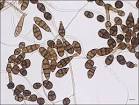 Alternaria alternata - Phadia - Setting the Standard - m