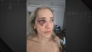 Passageira agredida por motorista de aplicativo de moto na Zona Sul