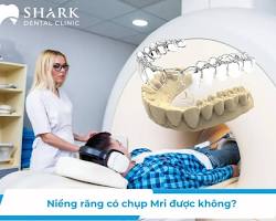Image of Chụp MRI nha khoa