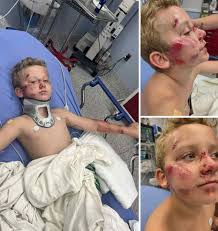 Hit-and-Run Incident in Fort Worth Texas: 8-Year-Old Boy Struck by SUV On the evening of September 5, 2025, an 8-year-old boy was the victim of a hit-and-run while riding his bike near