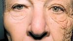  Shocking image of truck driver shows damage due to sun exposure over 28 years