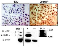 Image of SEB1 cells